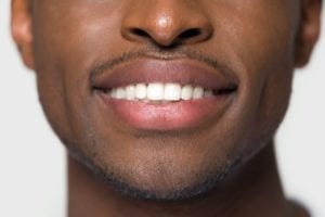 low-cost smile makeovers in Plano Texas