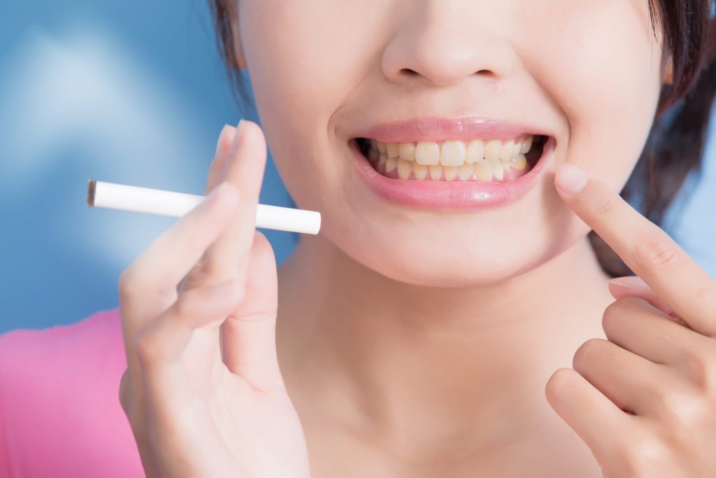 Tobacco and Oral Health in Plano, TX