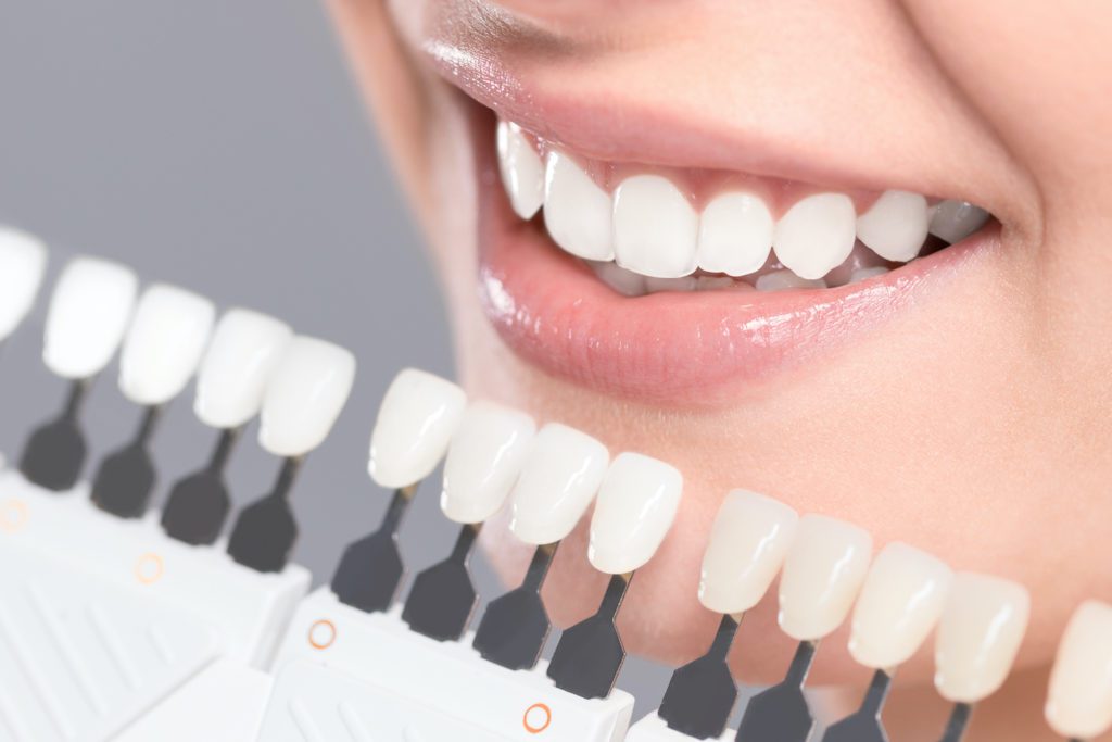 cosmetic dentist in plano, texas