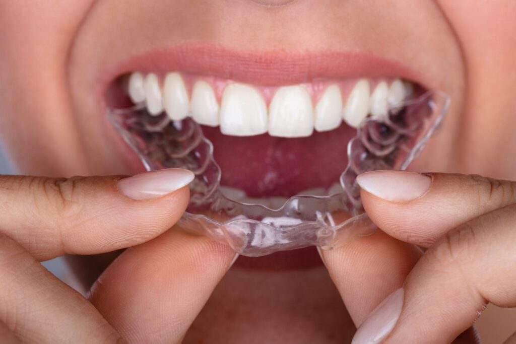 How Invisalign Can Improve Your Health
